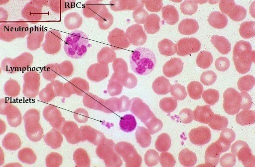 A close up of blood cells in the process of being stained.