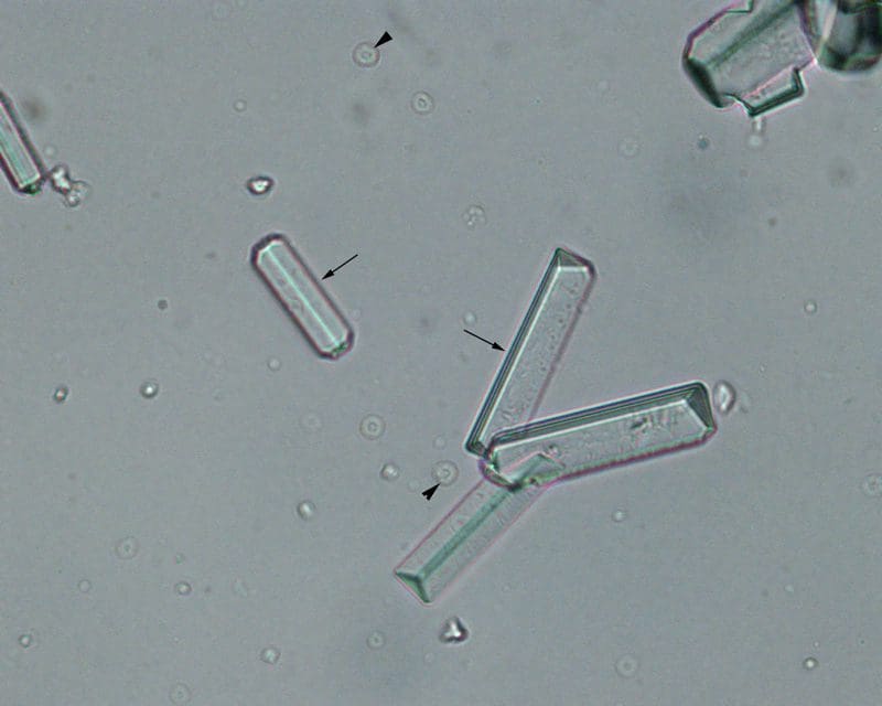 A close up of some type of bacteria