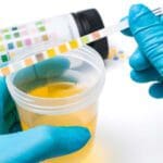 A person holding a cup of urine performing a urinalysis while wearing a pair of blue gloves.