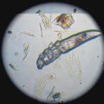 A microscope image of a mange mite.